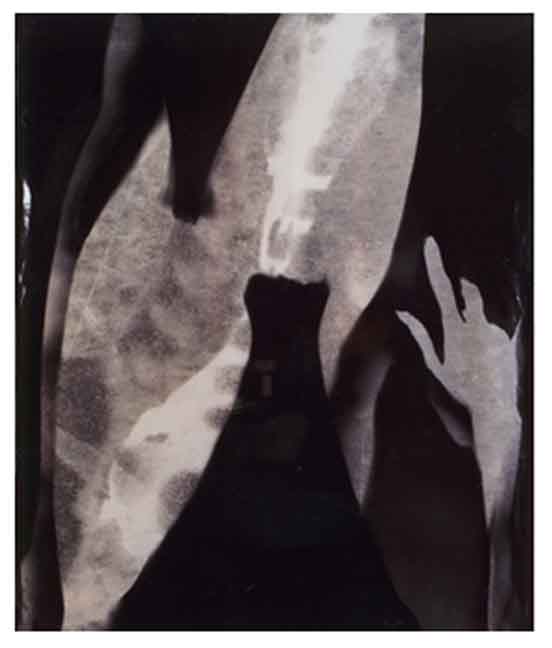 Photogram Models 05