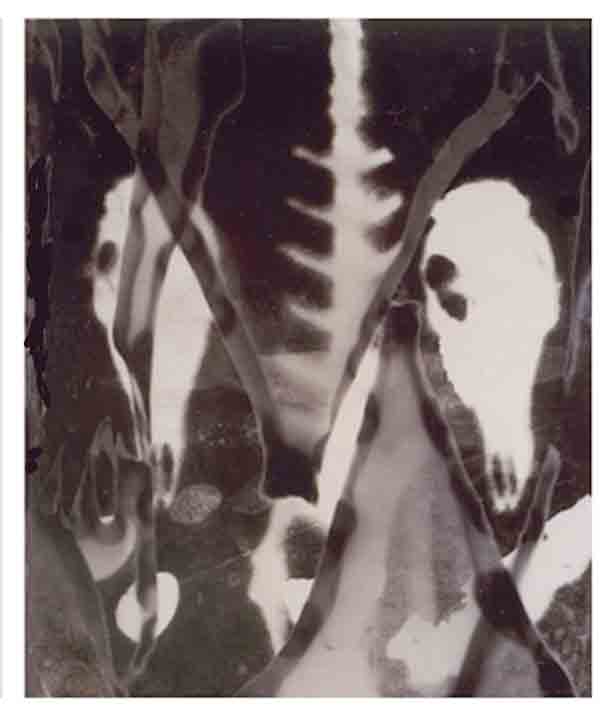 Photogram Vertebrae 02